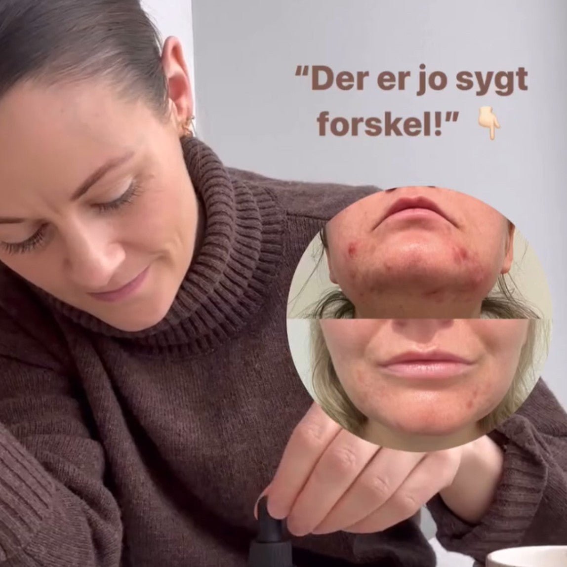 sensitiv hud