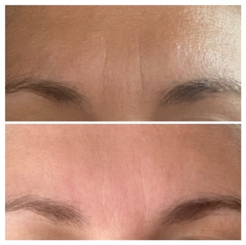 Mindsker bekymringsrunken